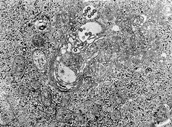Зображення тканини, яка була заражена вірусом гарячки Рифт Валлі (трансмісійна електронна мікрофотографія)