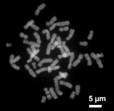 Metaphasechromosomen aus einem weiblichen menschlichen Lymphozyten, gefärbt mit Chromomycin A3.