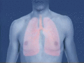 Asztmás roham következtében beszűkülő hörgők