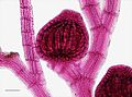 Carposporocito sobre el gametófito femenino