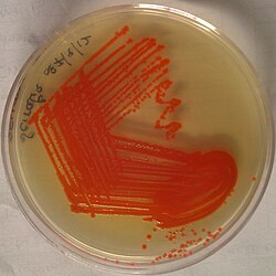 Serratia marcescens: red pigmentation: although considered characteristic of the species, only about 10% of specimens produce this pigment: 236 