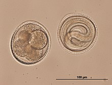 Dvě vajíčka škrkavky psí: vlevo vajíčko obsahující morulu (shluk buněk), vpravo vajíčko s larvou L3 (viditelný červ). Dole měřítko