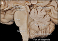 Midsagittal section of the brainstem.