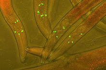 Záběr na několik háďátek, celá fotografie má hnědozelené odstíny. Jásavě zelené skvrnky vynikající na tělech červů představují značení zeleným fluorescenčním proteinem