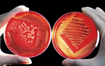 Red blood cell agar. Blood appears red due to the iron molecules in blood cells.