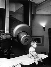 External beam radiotherapy retinoblastoma nci-vol-1924-300.jpg