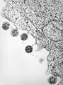 Humanes Herpesvirus 6 nach Freisetzung an der Zellmembran
