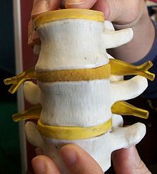 Model of a section of a spine.