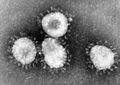 Coronaviruses viewed under an electron microscope
