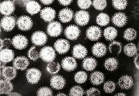 Isisu esihambisayoI-electron micrograph ye-rotavirus, unobangela ophantshe ubeyi-40% yokulaliswa esibhedlele ngenxa yesisu esihambisayo kubantwana abangapahntsi kweminyaka emihlanu.[1]