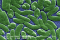 Image 20Vibrio vulnificus, a virulent bacterium found in estuaries and along coastal areas (from Marine prokaryotes)