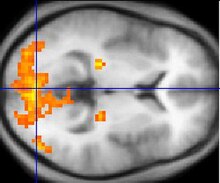 Монохромное фМРТ-изображение горизонтальной кросс-секции человеческого мозга. Несколько областей, в основном в задней части изображения, выделены оранжевым и жёлтым цветом.