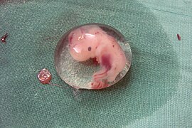 Human Embryo.JPG