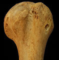 Left humerus. Anteriolateral view.