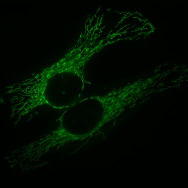 HeLa-Zellen, die Mitochondrien sind mit GFP markiert, welches mit einem entsprechenden Signalpeptid fusioniert ist.