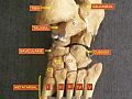 Foot bones - tarsus, metatarsus