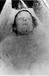 Mortuary photograph of Nichols: a middle-aged woman with short, mousey hair and a prominent, narrow nose