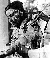 Toyoko Kugata, víctima de 22 años en tratamiento en el Hospital de Cruz Roja de Hiroshima (6 de Agosto de 1945).