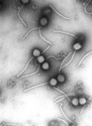 Viruso - Gamma phage