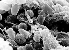 Skaneeriva elektronmikroskoobi kujutis katkubakteriga nakatunud kirbu soolestikust.
