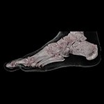 CT 3D human Foot Skin and Bone