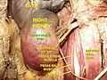 Right Kidney