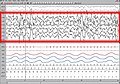 EEG tokom N3 stadijuma NREM spavanja (stadijumi 3 i 4 po staroj klasifikaciji)