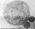 Image 52Two Nanoarchaeum equitans cells with its larger host Ignicoccus (from Marine prokaryotes)