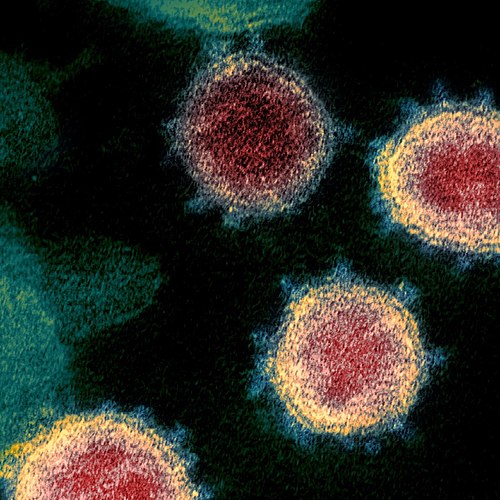 Novel Coronavirus SARS-CoV-2 - cropped.jpg