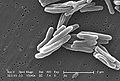 Mycobacterium tuberculosis (Actinobacteria)