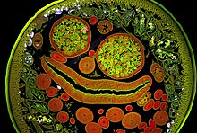 kolorovaná mikroskopická fotografie průřezu helmintem rodu škrkavka; patrný je jak lumen střeva uprostřed, tak výrazné rozmnožovací orgány a stavba tělní stěny